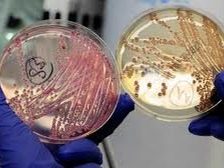 Petrischalen met bacteriekweek